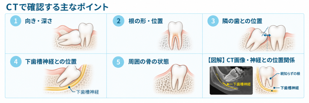 CTで確認する主なポイント